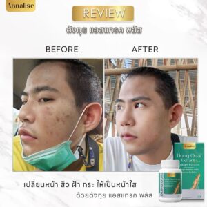 Annalise Dong Quai Extract