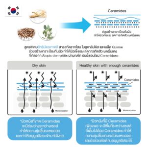 Dr. Pong Natural Volcanic Sulphur Soap 3 Percent Salicylic Acid 2 Percent 70g