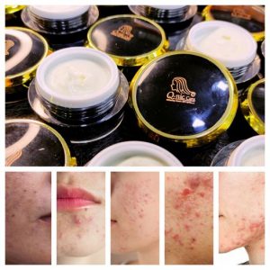 Q-nic Care Whitening Night Cream