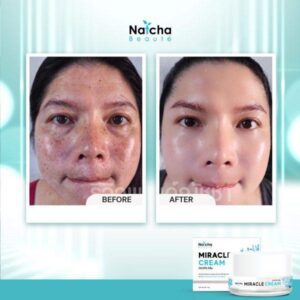 Natcha Miracle Cream 18g Anti Aging Brightening Facial Cream