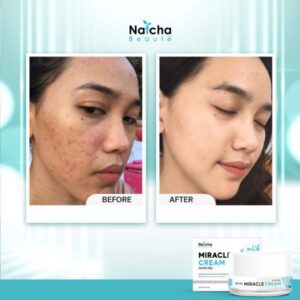 Natcha Miracle Cream 18g Anti Aging Brightening Facial Cream