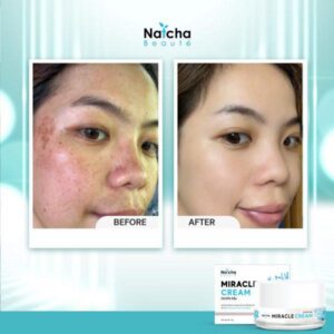 Natcha Miracle Cream 18g Anti Aging Brightening Facial Cream