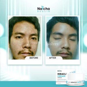 Natcha Miracle Cream 18g Anti Aging Brightening Facial Cream