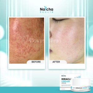 Natcha Miracle Cream 18g Anti Aging Brightening Facial Cream