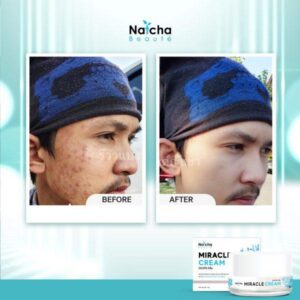 Natcha Miracle Cream 18g Anti Aging Brightening Facial Cream