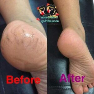 Mrs. Foot Spa Heel Scrub