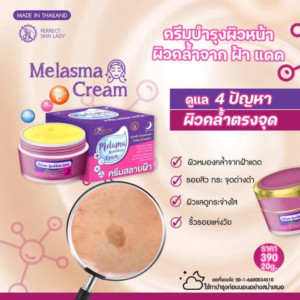 Perfect Skin Lady Melasma Breakdown Cream 20g dark spot and melasma care skincare product