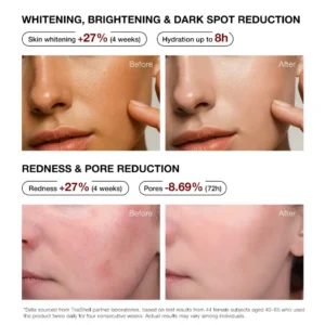 Teashell Niacinamide Brightening Serum 30ml Thailand