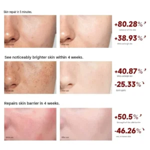 Teashell Niacinamide Brightening Skin Essence Cream – Hydrating Facial Moisturizer for Radiant, Even-Looking Skin