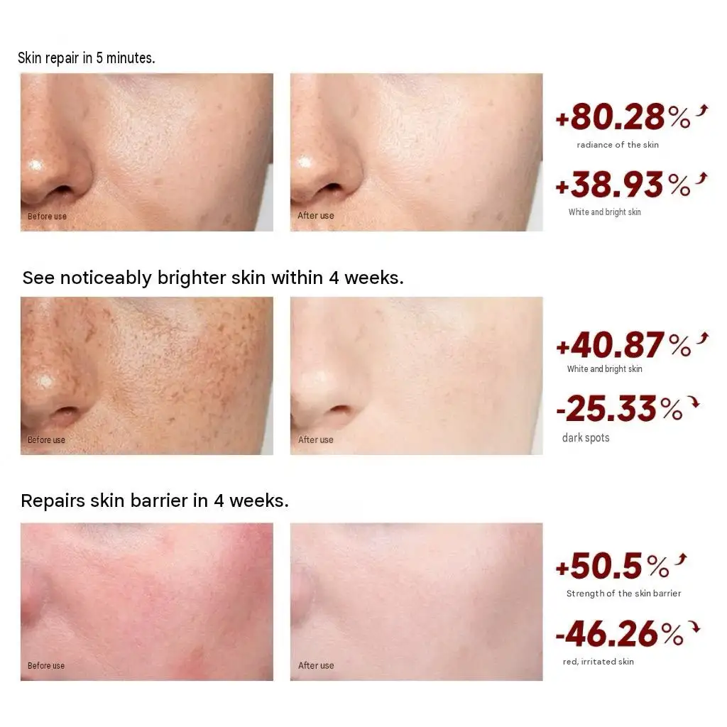 Teashell Niacinamide Brightening Skin Essence Cream – Hydrating Facial Moisturizer for Radiant, Even-Looking Skin